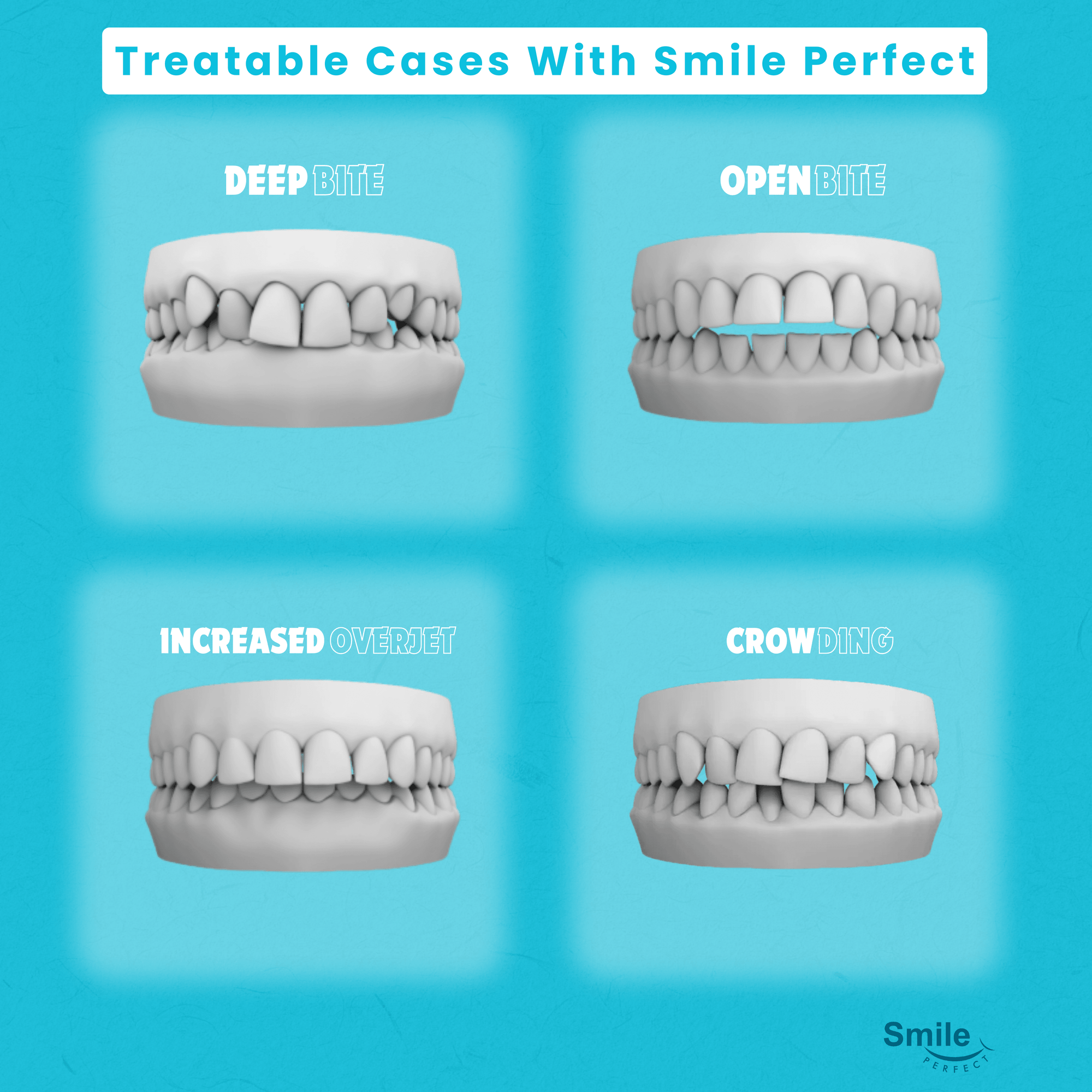 Smile Perfect Premium Single Arch